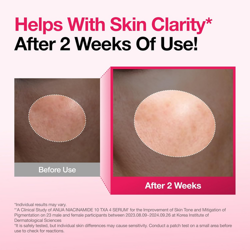 ANUA 10% Niacinamide+ 4% TXA Serum